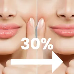 Przed i po zabiegu powiększania ust 0,5 ml. Widoczny efekt 30% pełniejszych warg.