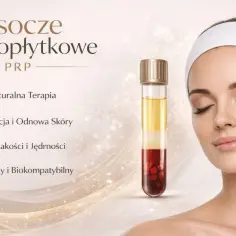 Kobieta otrzymuje zabieg osoczem bogatopłytkowym na twarz. Terapia PRP dla regeneracji i odmłodzenia skóry.