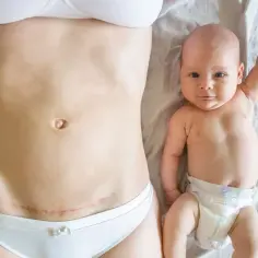 Brzuch mamy z widoczną fałdą nad blizna po cesarce i uśmiechniętym noworodkiem obok.