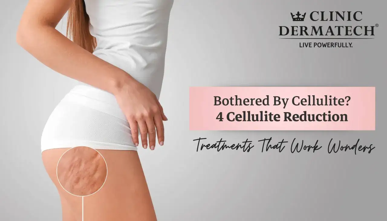 Kobieta z widocznym cellulitem na udzie. Reklama zabiegów na cellulit w Clinic Dermatech.