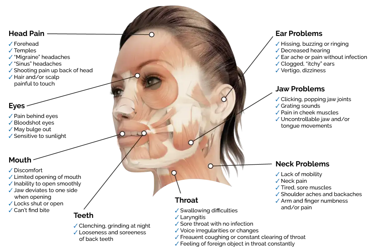 Anatomia twarzy z zaznaczonymi punktami iniekcji botoksu. Pomoc w leczeniu bruksizmu i zmarszczek.